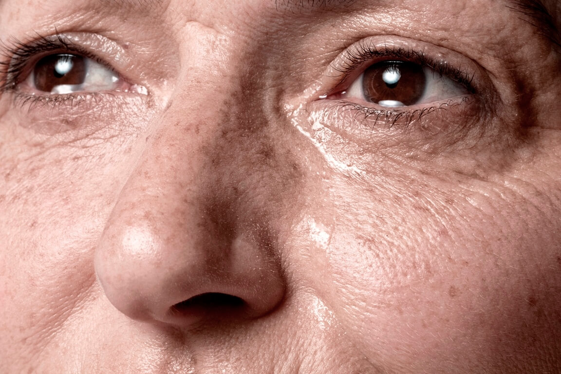 Чому у людей похилого віку з'являються пігментні плями?